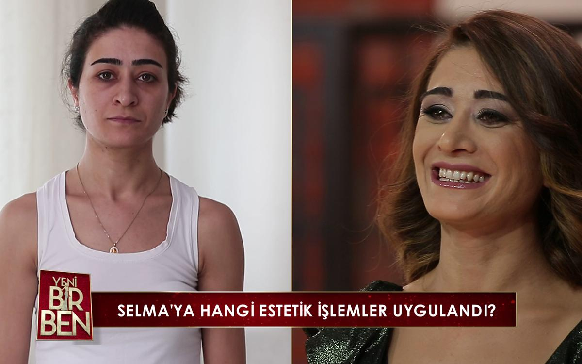 Selma Fırat'ın Şaşırtan Değişimi!