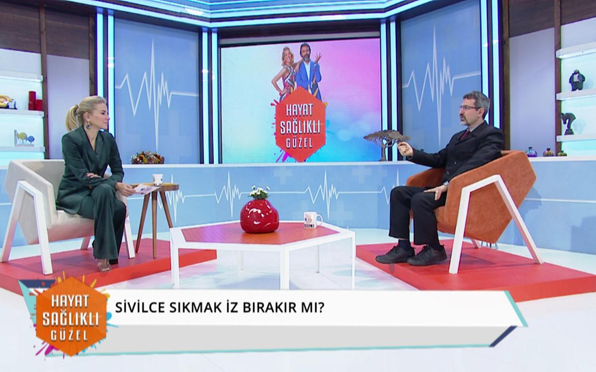 Sivilce nedir? Neden oluşur? Tedavi yöntemleri nelerdir?