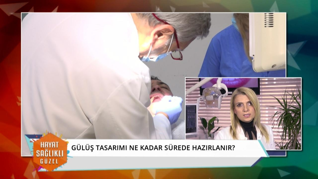 Kişiye özel gülüş tasarımı nedir?