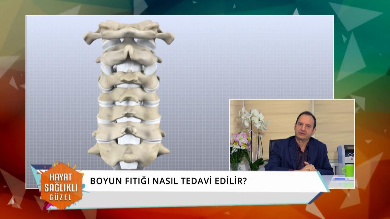 Boyun fıtığı nedir, nasıl tedavi edilir, ameliyat şart mı?