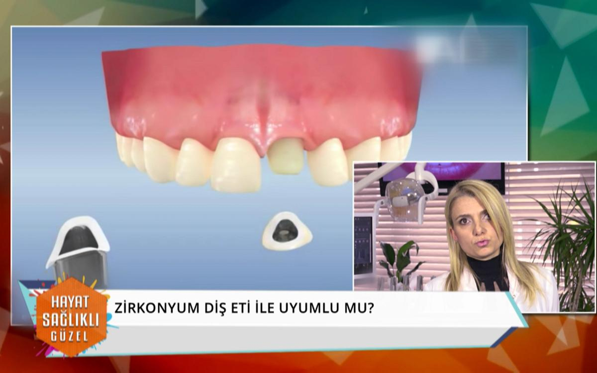 Zirkonyum diş nedir?