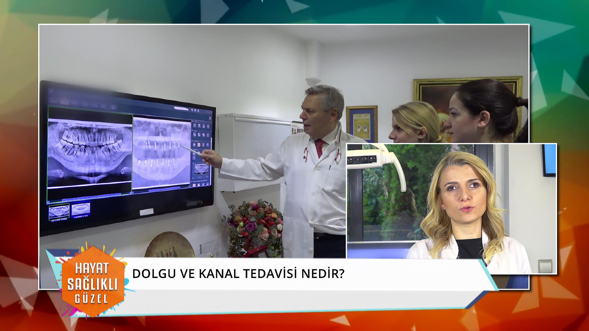 Dolgu ve kanal tedavisi nedir?