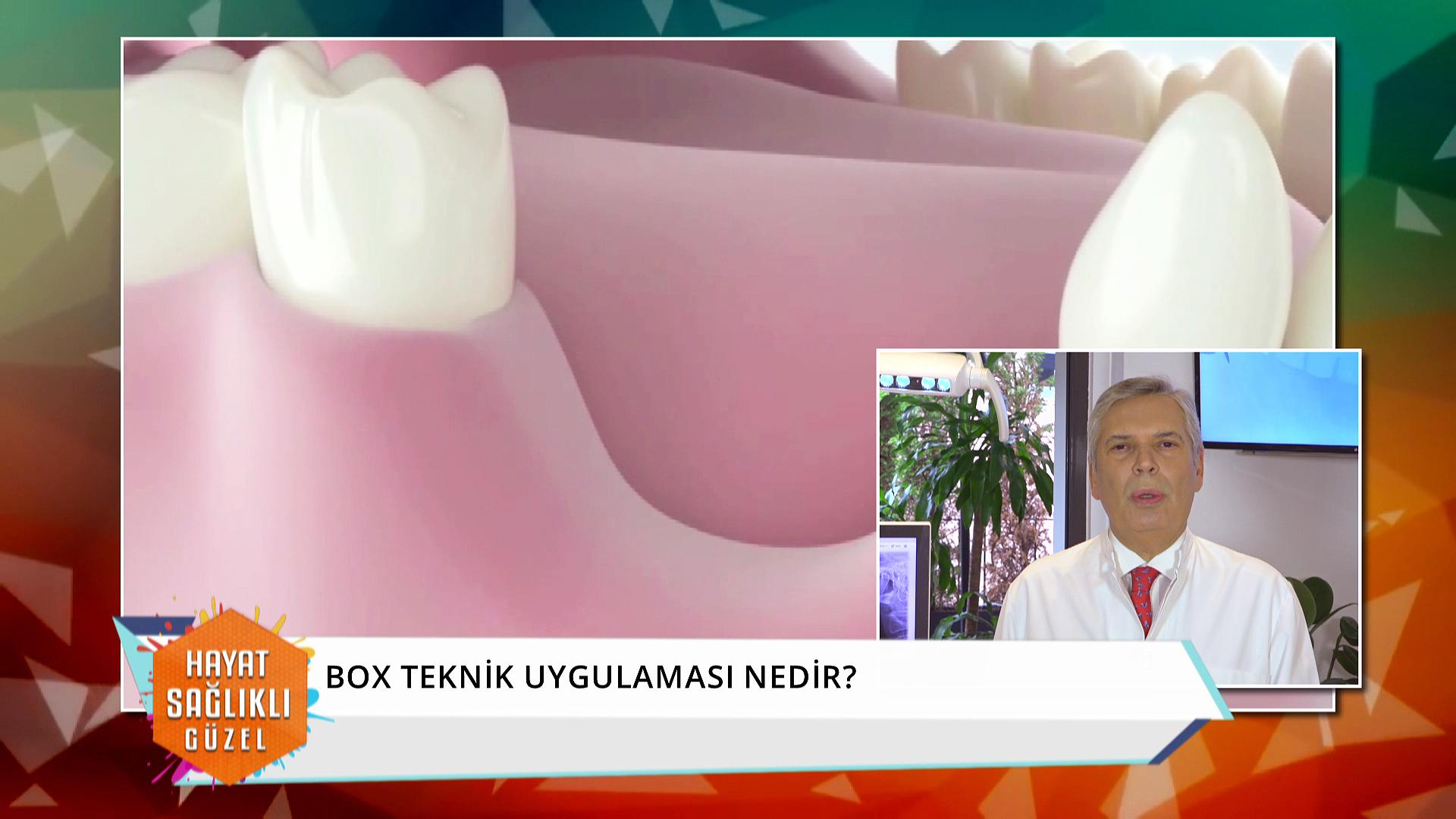 Box teknik uygulaması nedir?