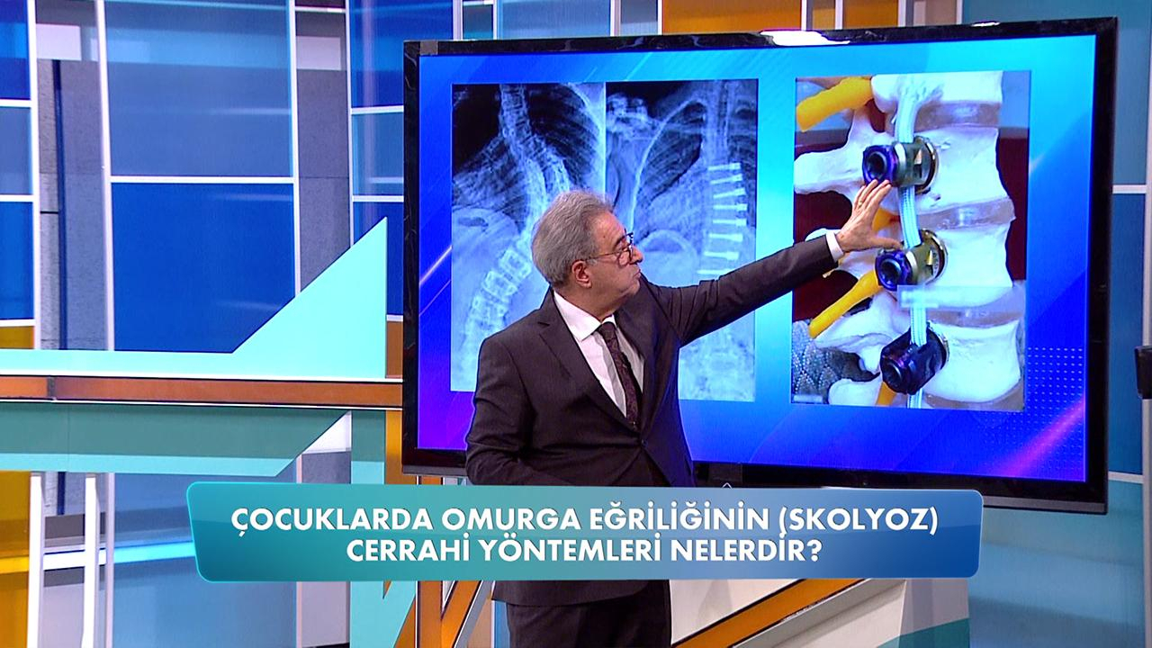 Skolyoz hastalarında cerrahi müdahale ne zaman yapılmalı?