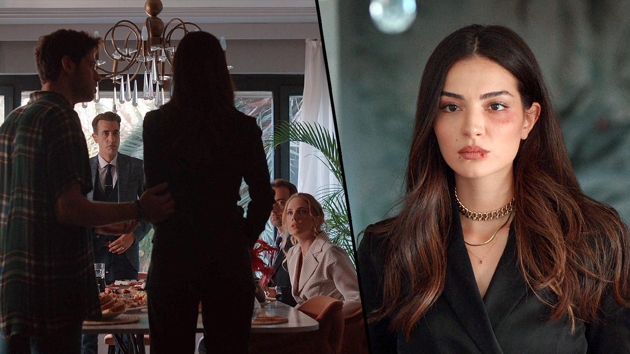 Yasemin, artık şiddeti saklamıyor!