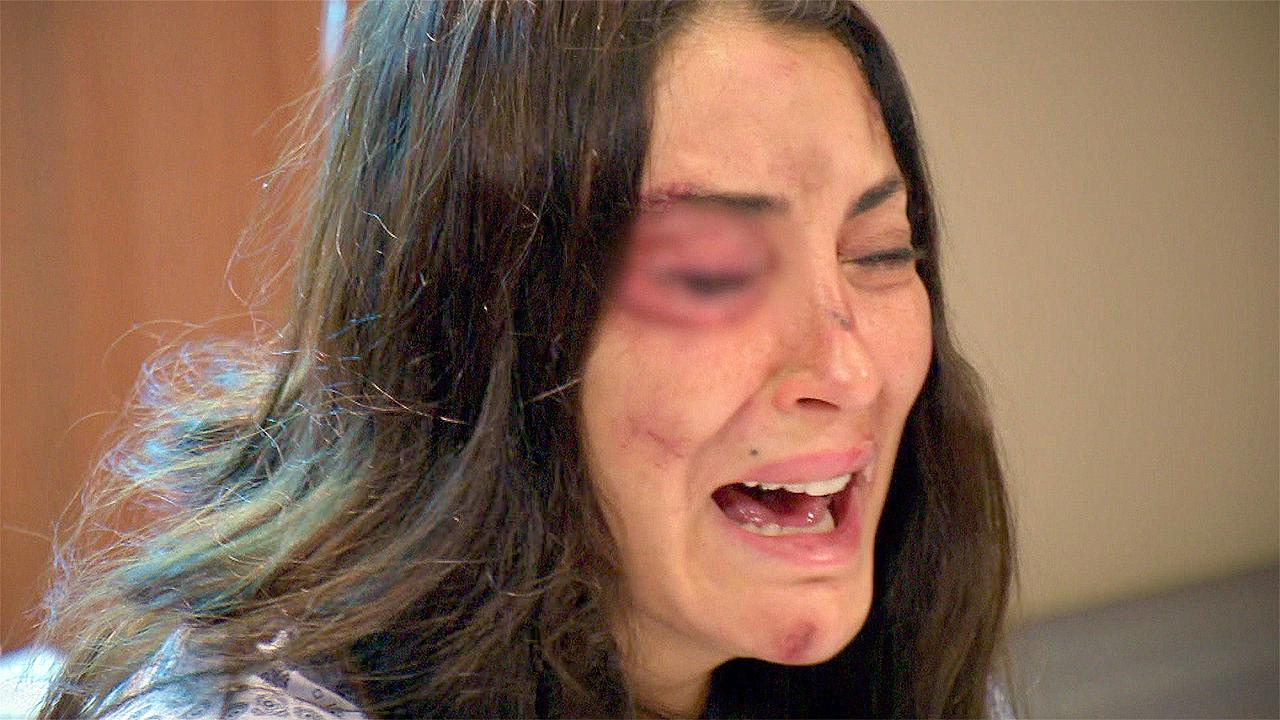 Bahar, dağılmış yüzünü görünce yıkılıyor!