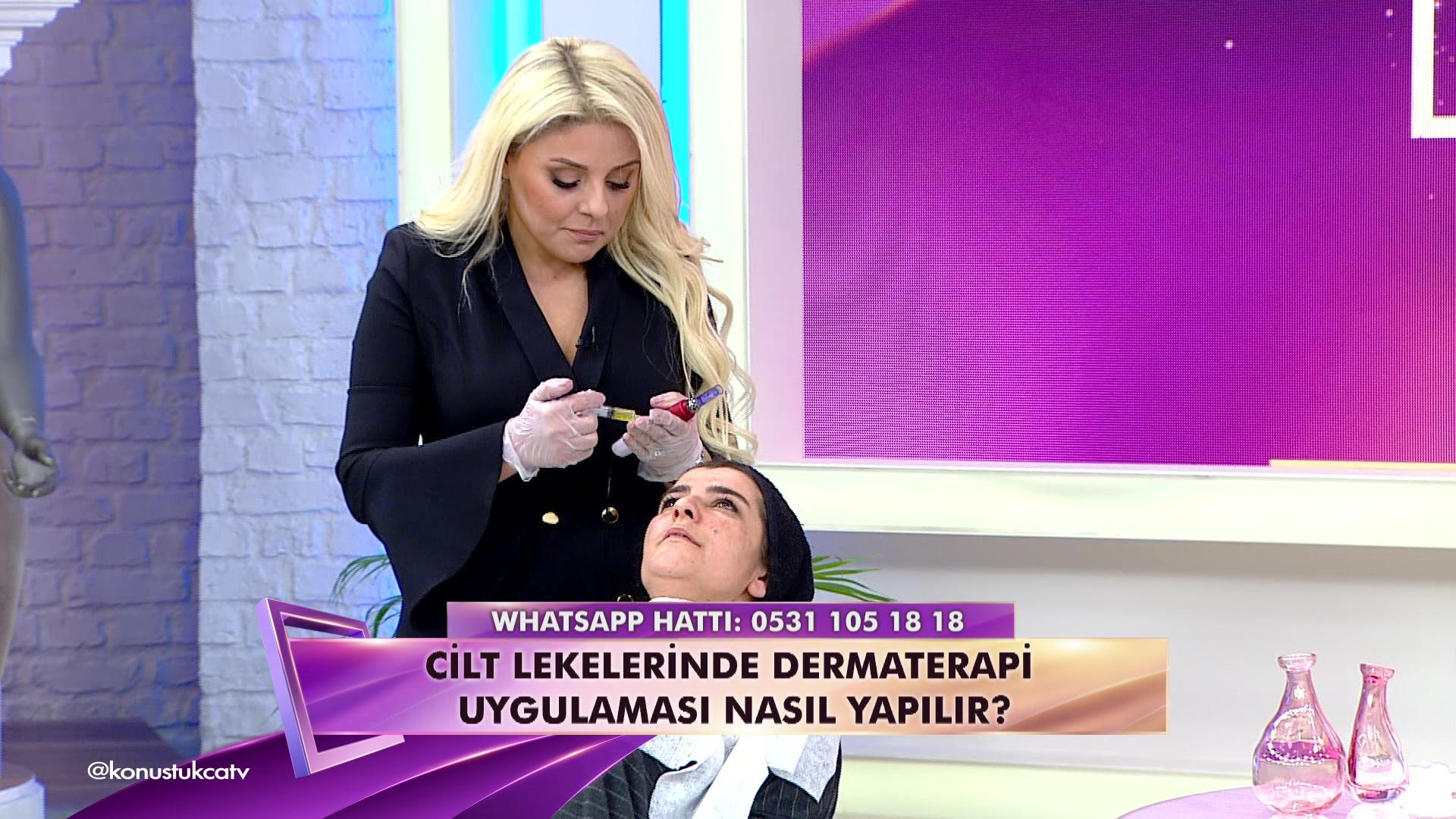 Cilt lekelerinde Dermaterapi uygulaması nasıl olur?