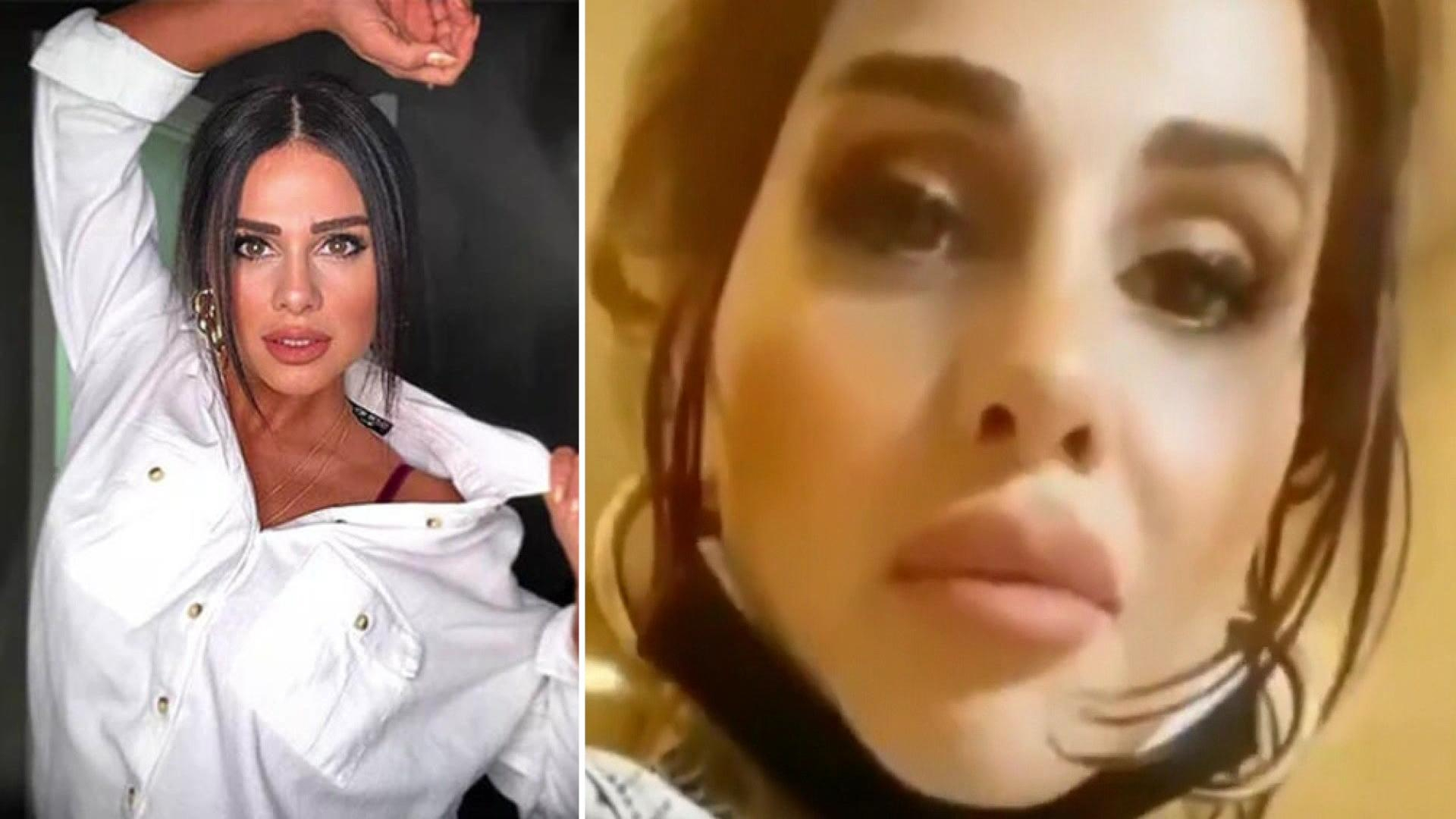 Günel, estetik yorumlarına fena patladı!