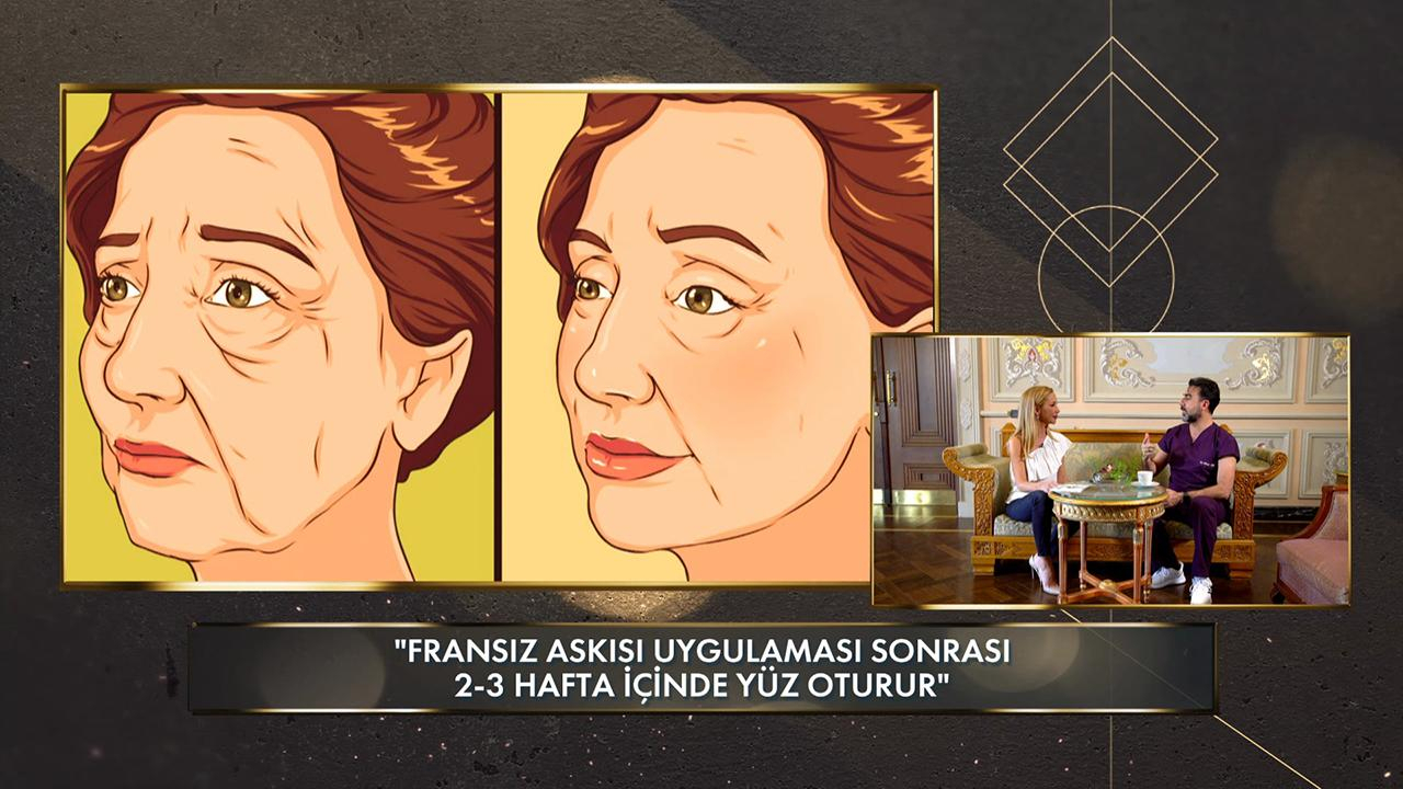 İple yüz germe yöntemlerindeki son trendler neler?