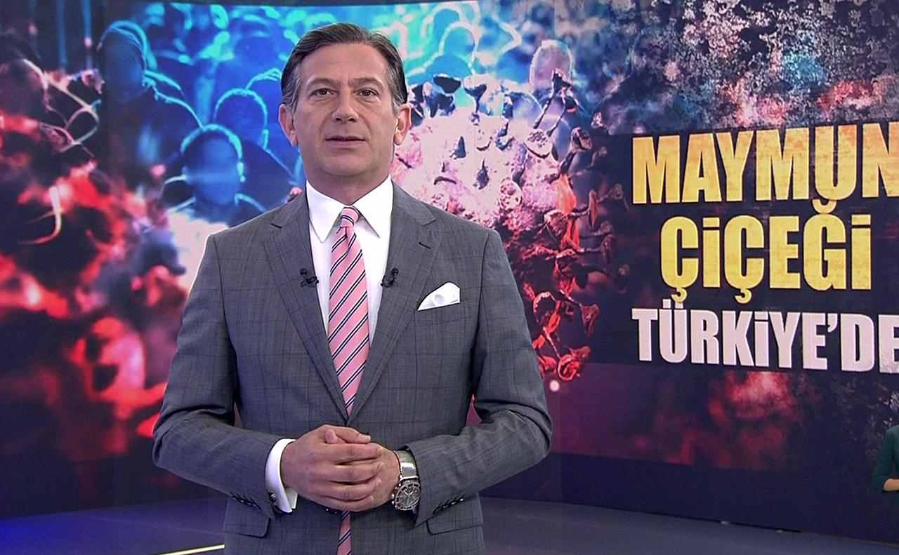 Türkiye’de ilk maymun çiçeği vakası tespit edildi!