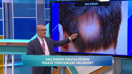Saç kıran nasıl tedavi edilir?