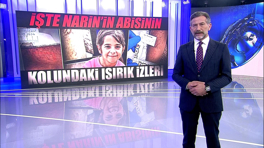 İşte Narin'in abisinin kolundaki ısırık izleri!