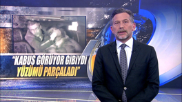 "Kabus görüyor gibiydi, yüzümü parçaladı"
