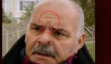 Rasim Öztekinnin Alnındaki Gizli Şifre Ne?