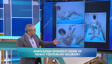 Ankilozan Spondilit nedir?