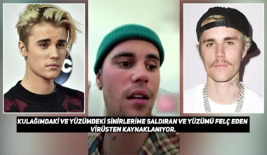 Justin Bieber'dan yüz felci şoku!