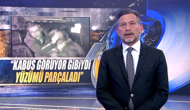 "Kabus görüyor gibiydi, yüzümü parçaladı"
